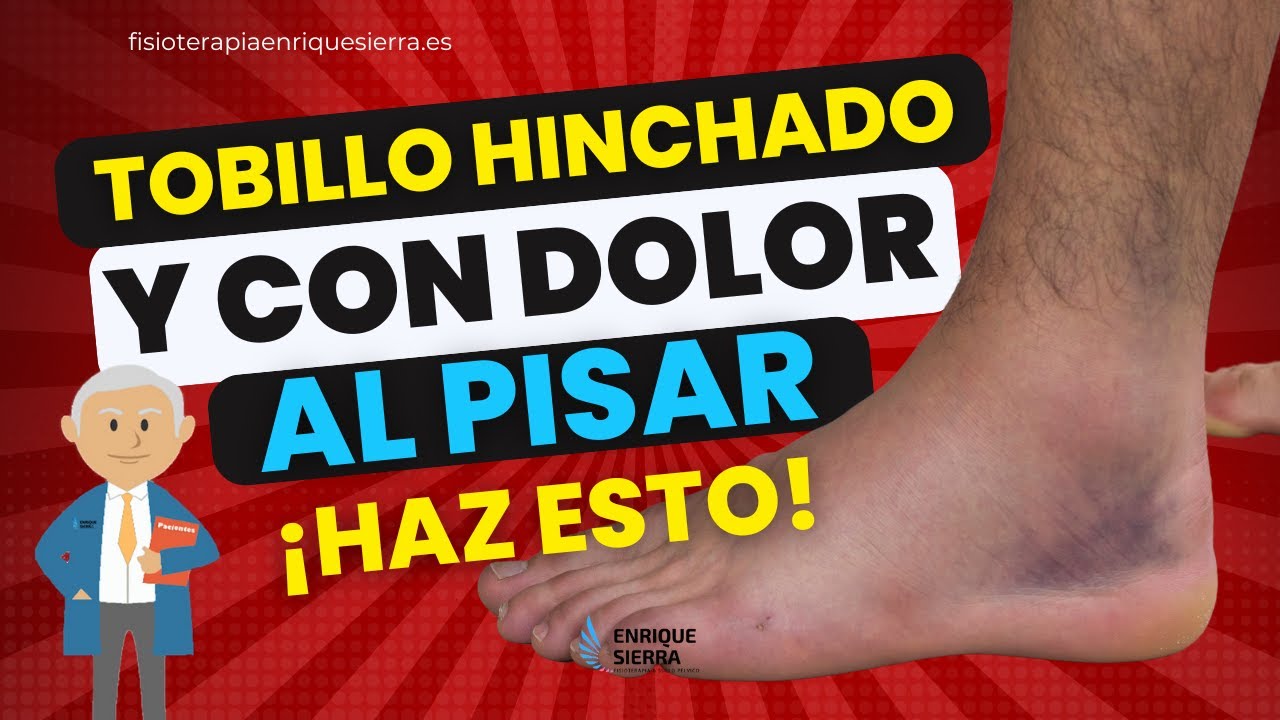 empeine del pie hinchado por golpe