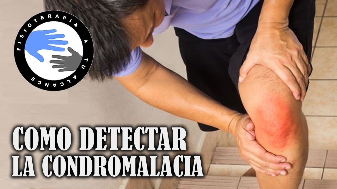 es bueno andar para la condromalacia rotuliana
