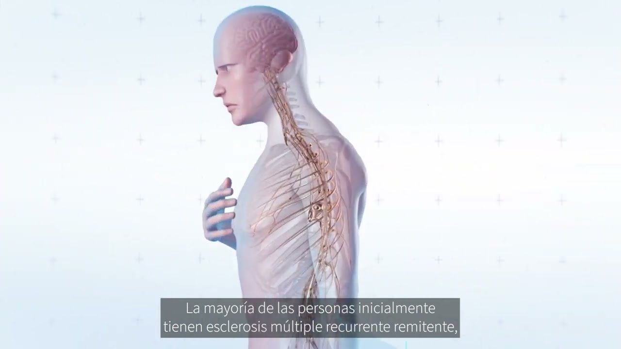 esclerosis en la columna vertebral tratamiento