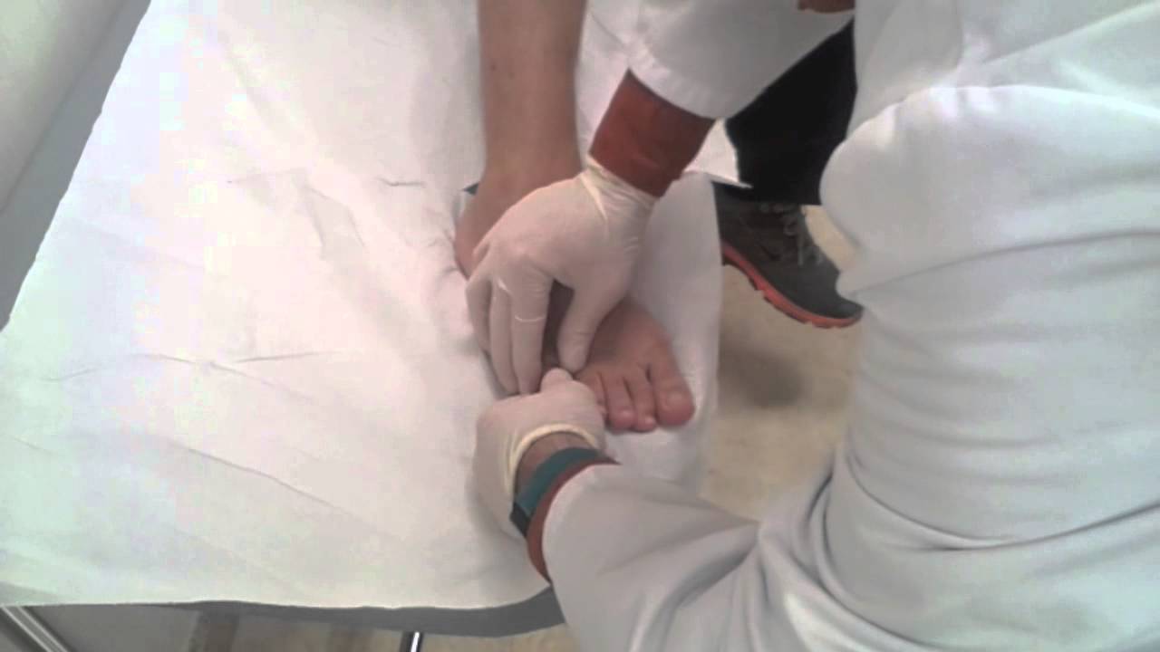 fractura falange proximal 5 dedo pie