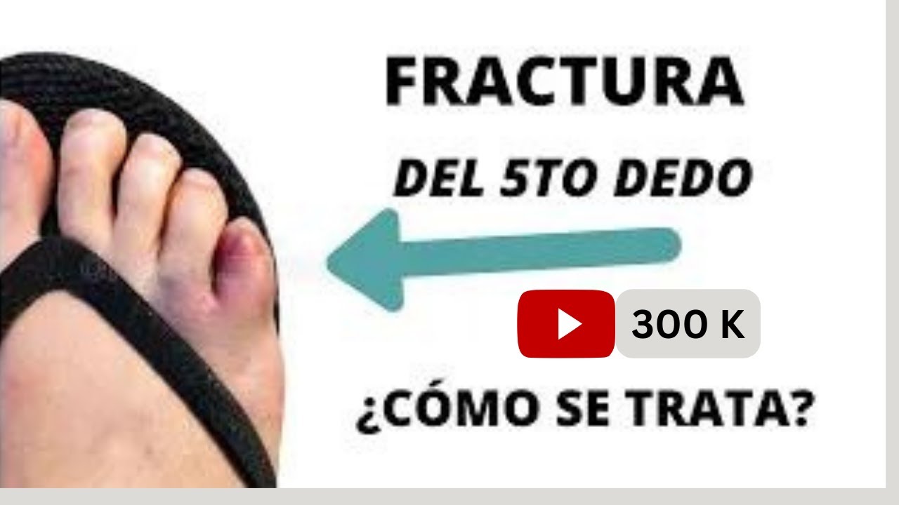 golpe en el dedo pequeño del pie