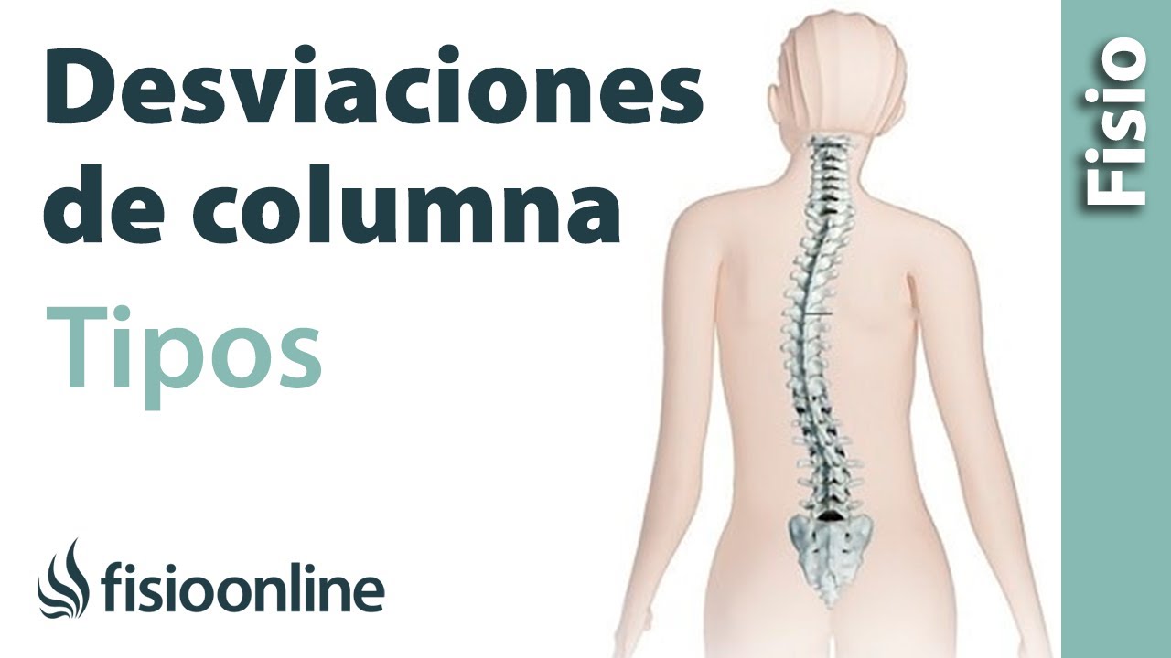las desviaciones de la columna vertebral