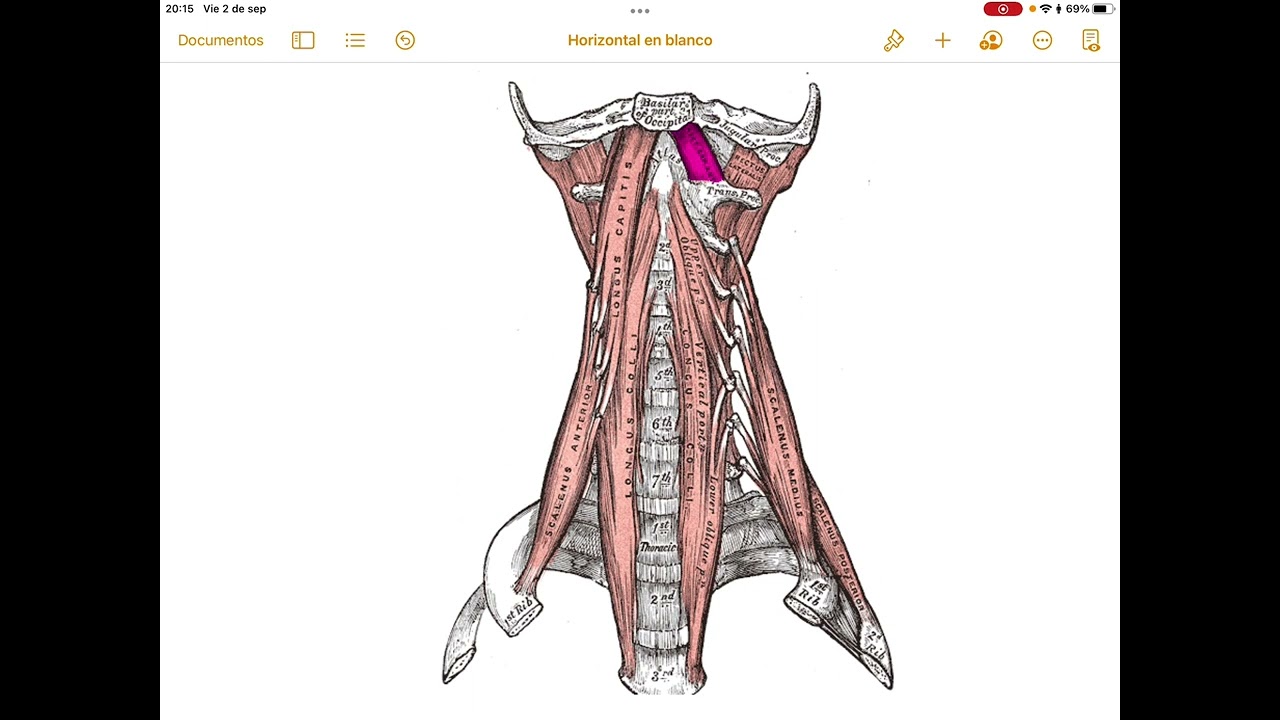 musculo recto menor de la cabeza