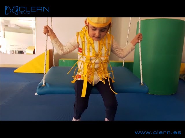 niños con hipotonia y retraso psicomotor