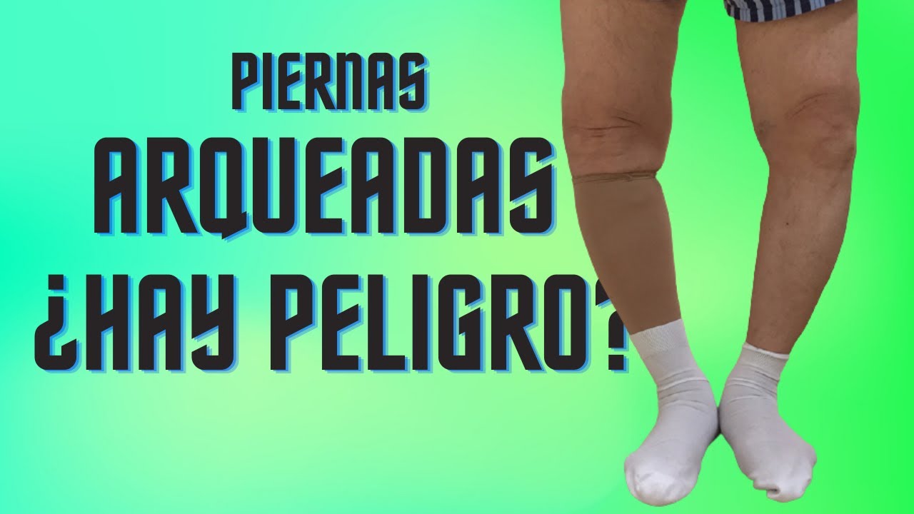 piernas arqueadas hacia afuera en adultos