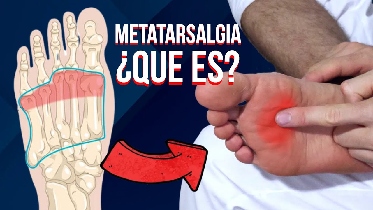 porque duele el metatarso del pie