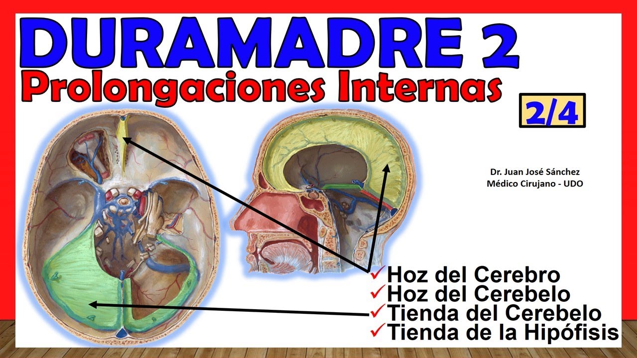 que es la tienda del cerebelo