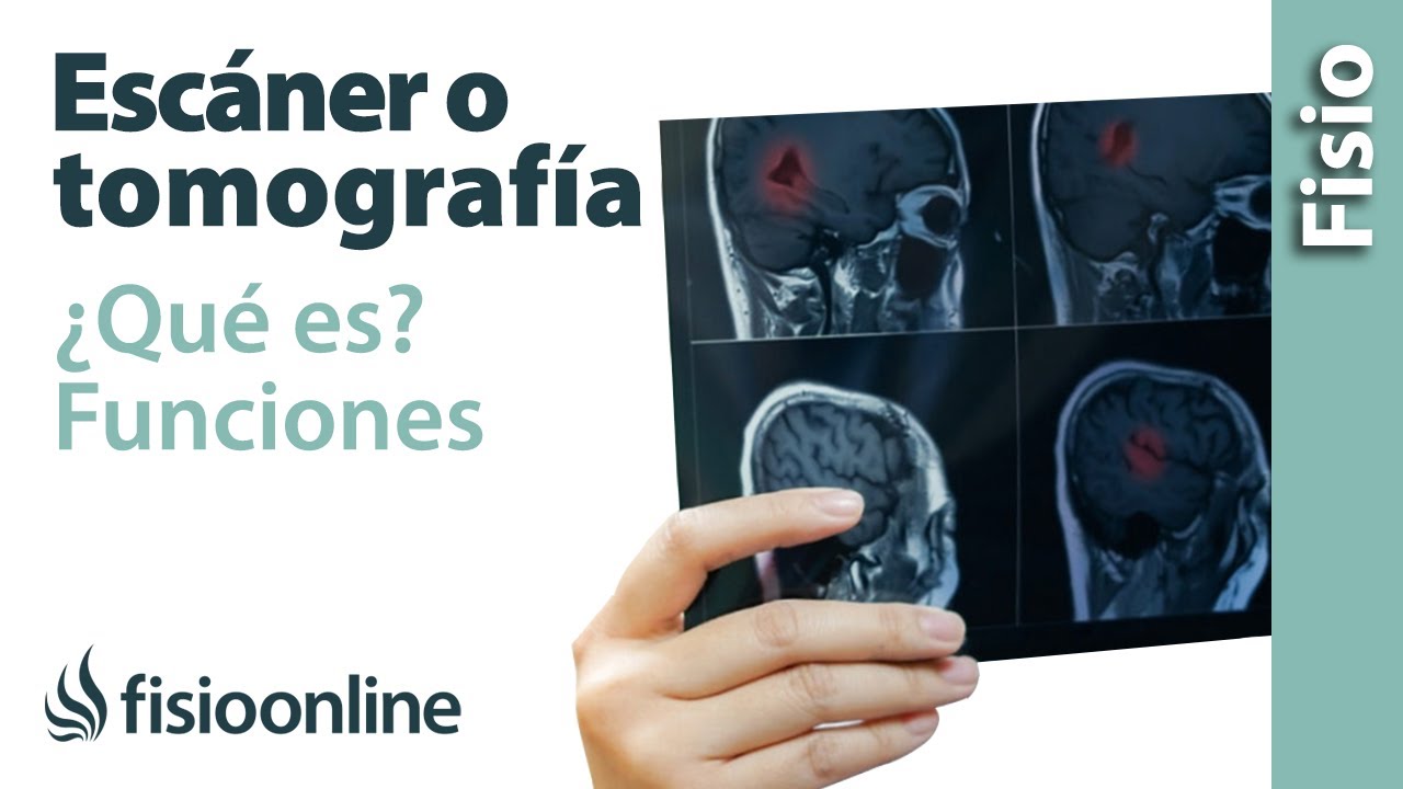 que es un escaner en medicina