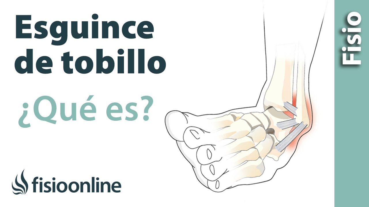 que es una contusion en el tobillo