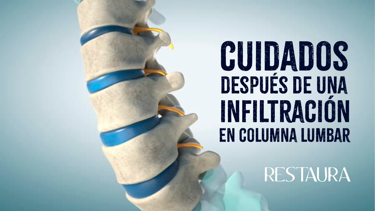 recuperacion despues de un bloqueo lumbar