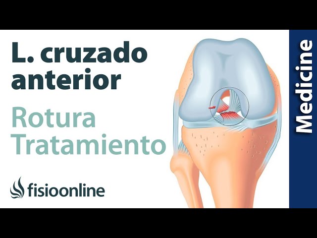 recuperacion rotura de ligamento cruzado anterior