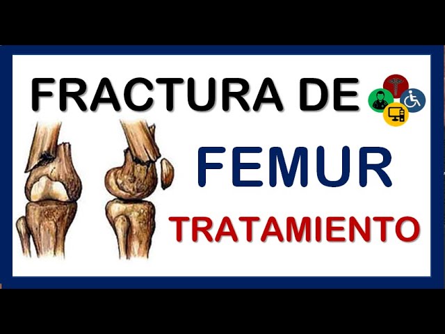 rotura de femur tiempo de recuperacion