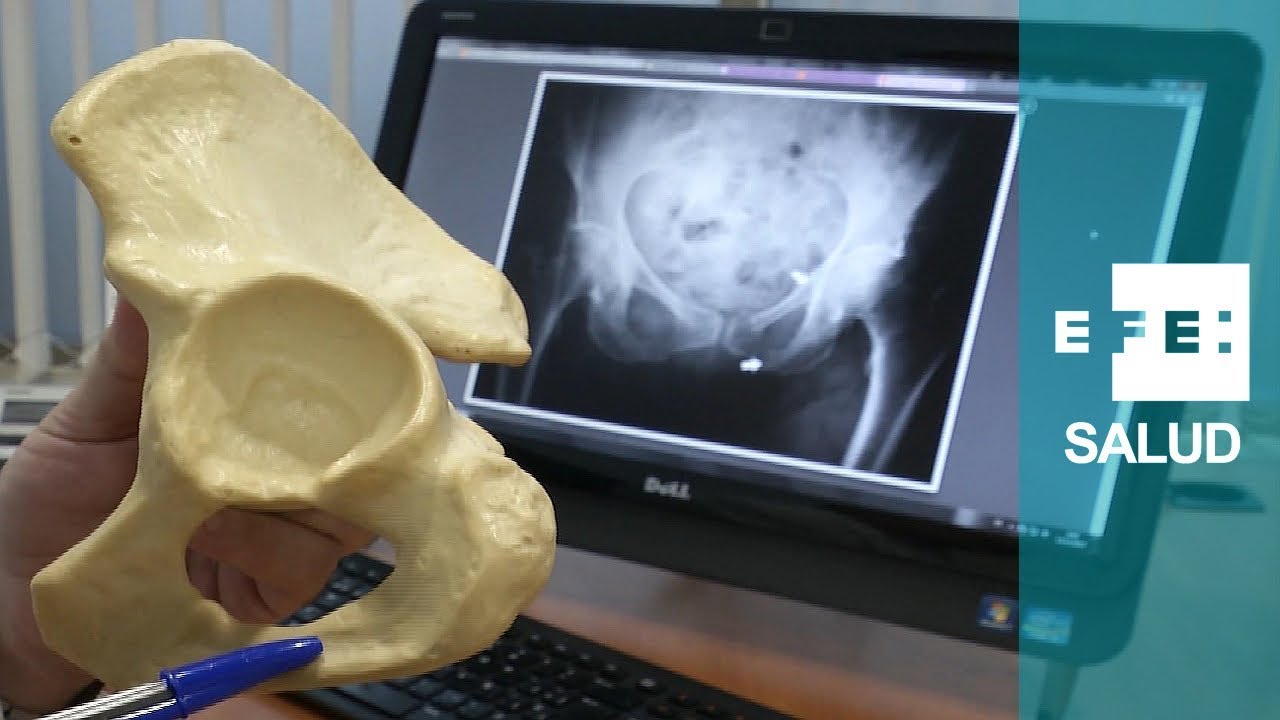 rotura de pelvis en ancianos recuperacion
