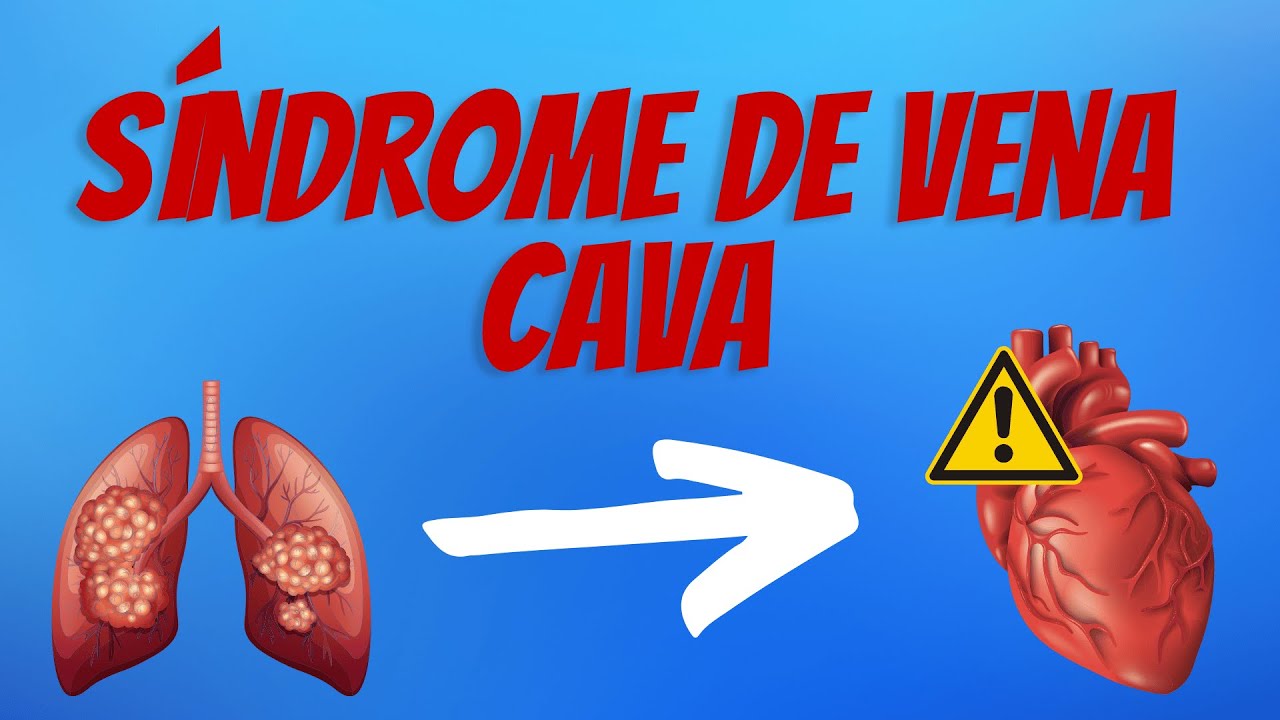 sindrome de vena cava superior tratamiento