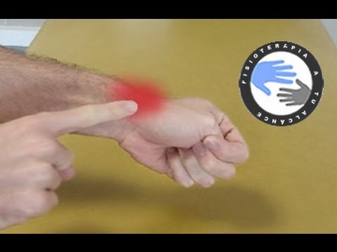 terapia para tendones de la mano