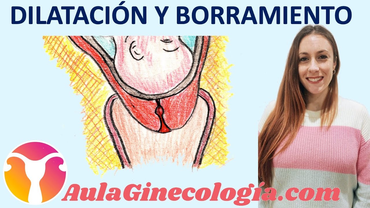 un tacto puede desencadenar el parto