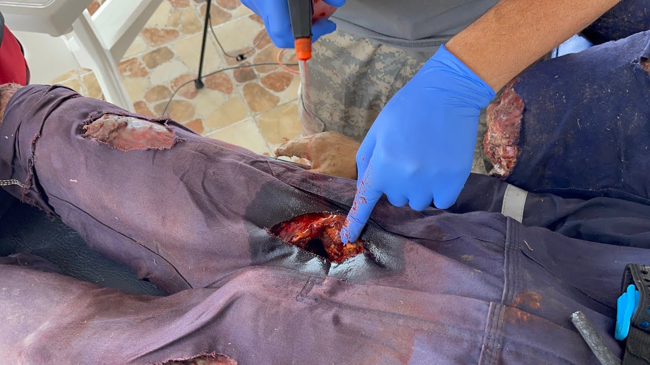 arteria femoral muerte tiempo de sangrado