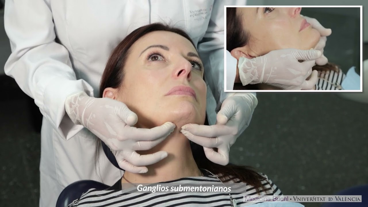 cadena cervical superficial y profunda inflamada