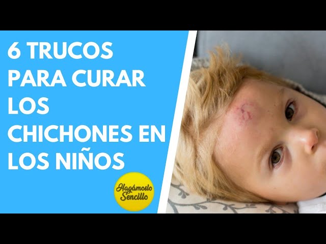 como bajar un chichon de mucho tiempo