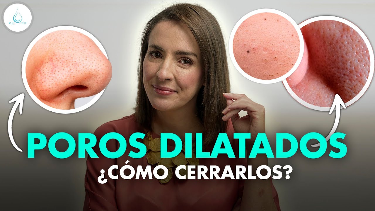 como cerrar los poros abiertos de la espalda