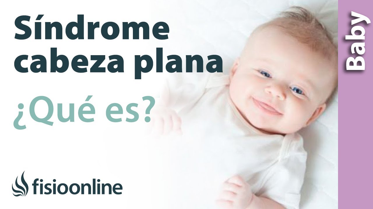 como evitar la cabeza plana en bebes