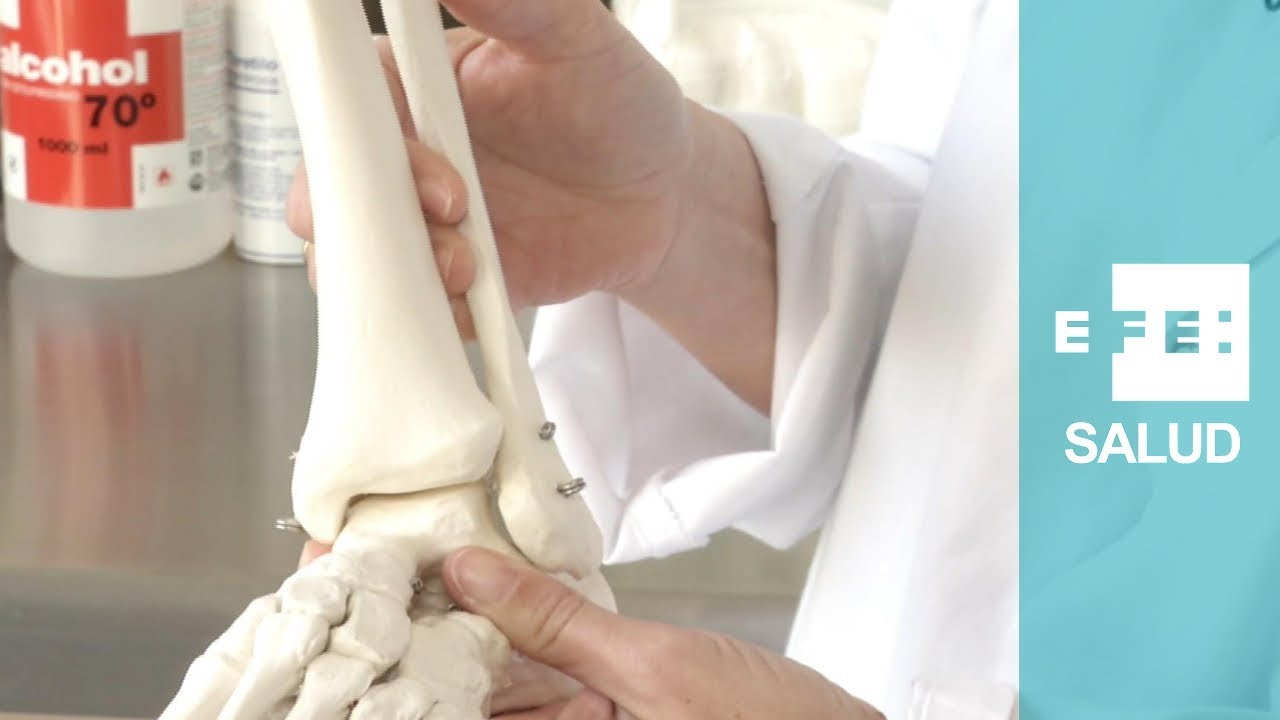 como recuperar una fractura de perone