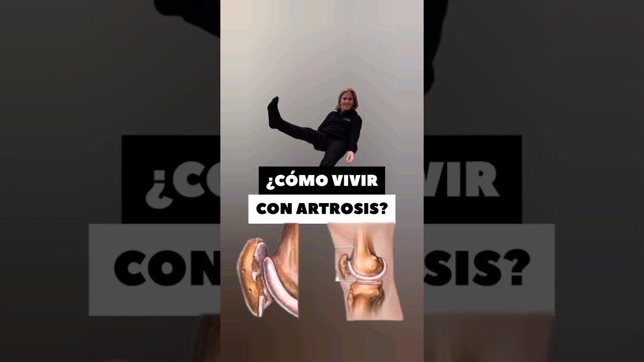 como vivir con artrosis de columna