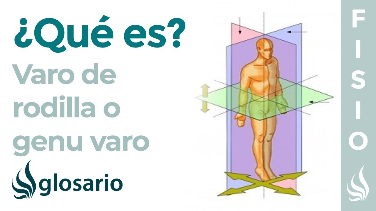 desviacion en varo de la rodilla