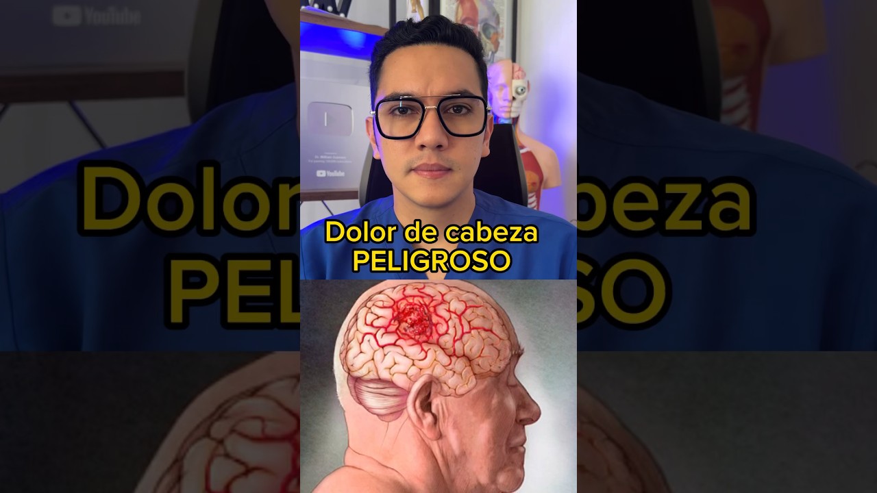 dolor de cabeza cuando esta nublado