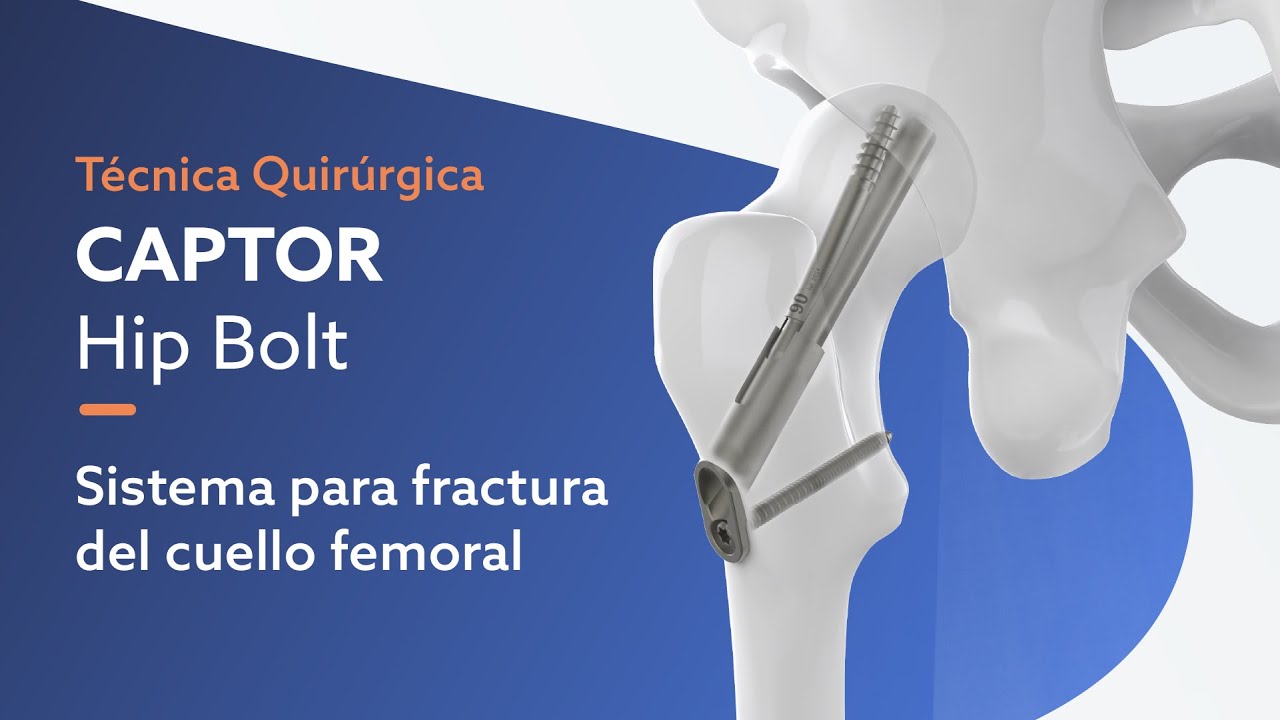 fractura de cuello de femur tratamiento