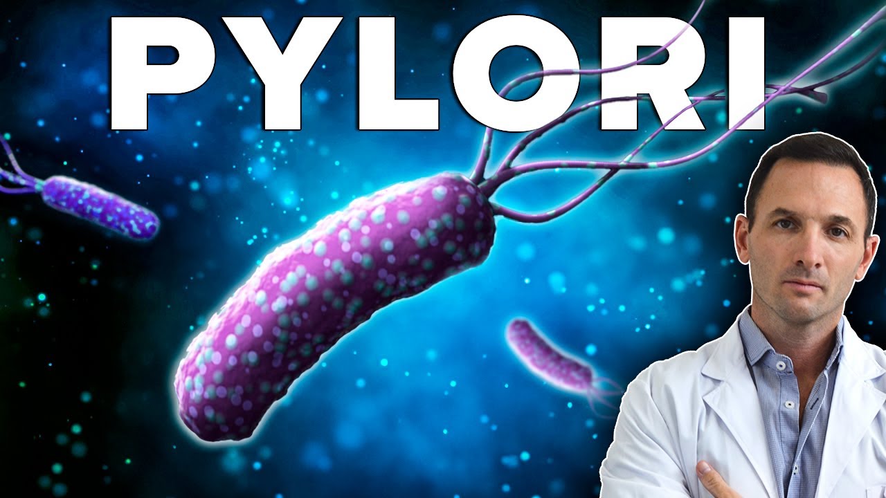 helicobacter pylori y dolor de espalda