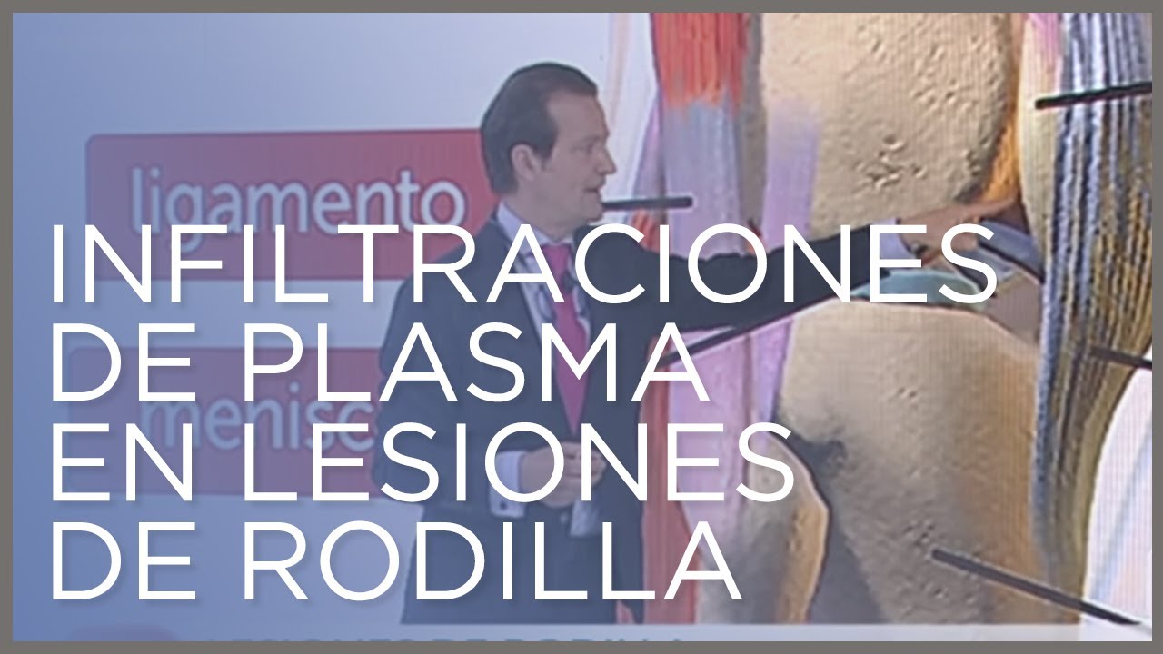 inyeccion de plasma en la rodilla