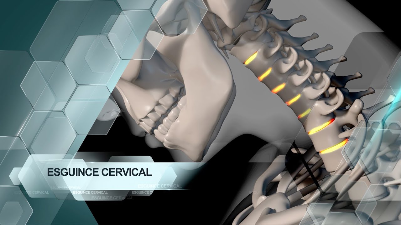 lesiones en el cuello por caidas