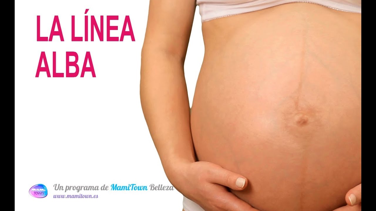 linea alba en mujeres no embarazadas