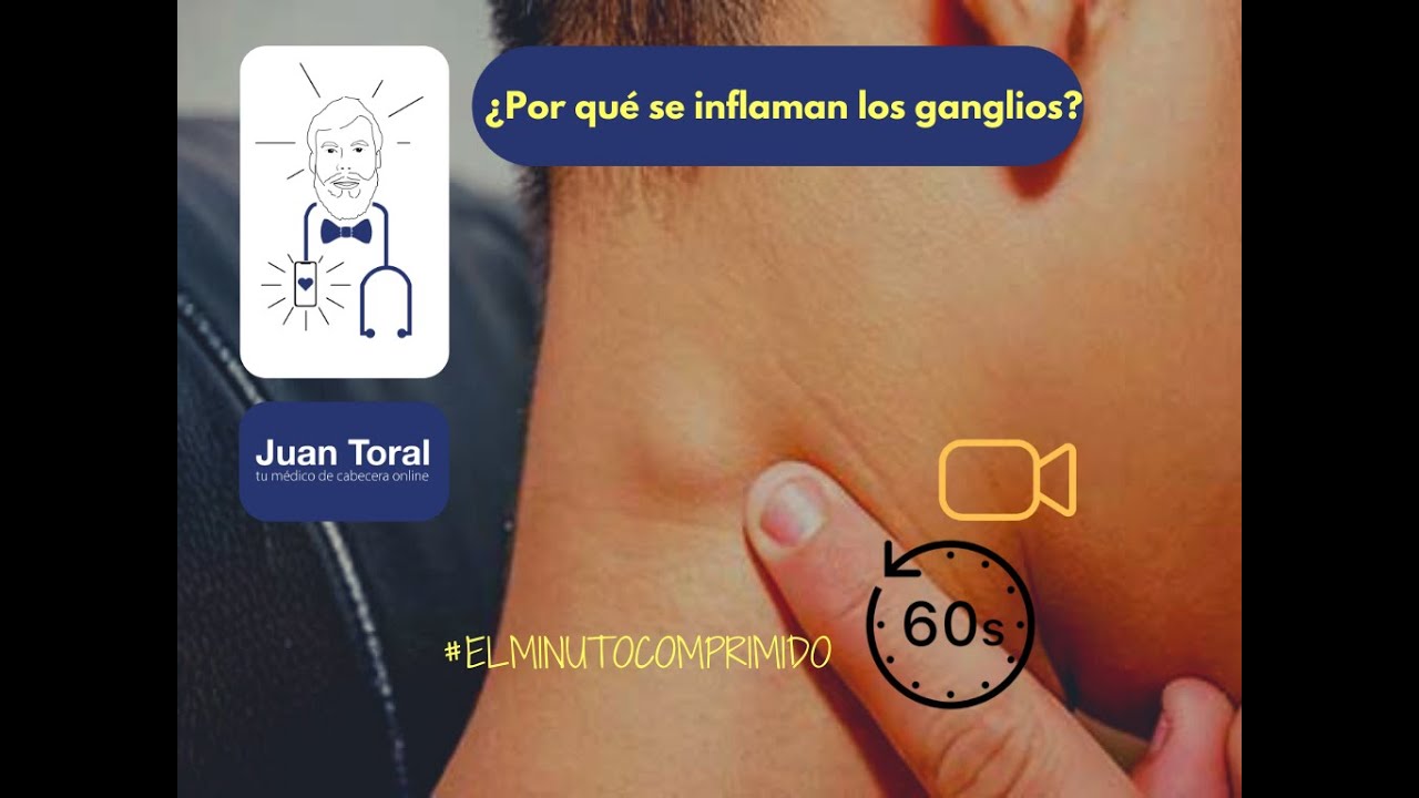los ganglios del cuello se inflaman por estres