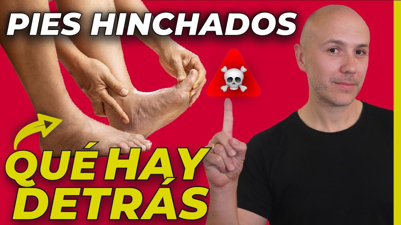 medico especialista en retencion de liquidos