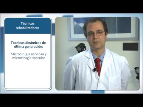 paralisis facial periferica tiempo de recuperacion