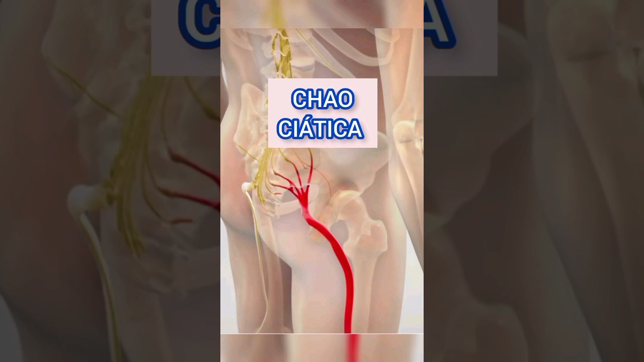 plantas medicinales para curar la ciatica