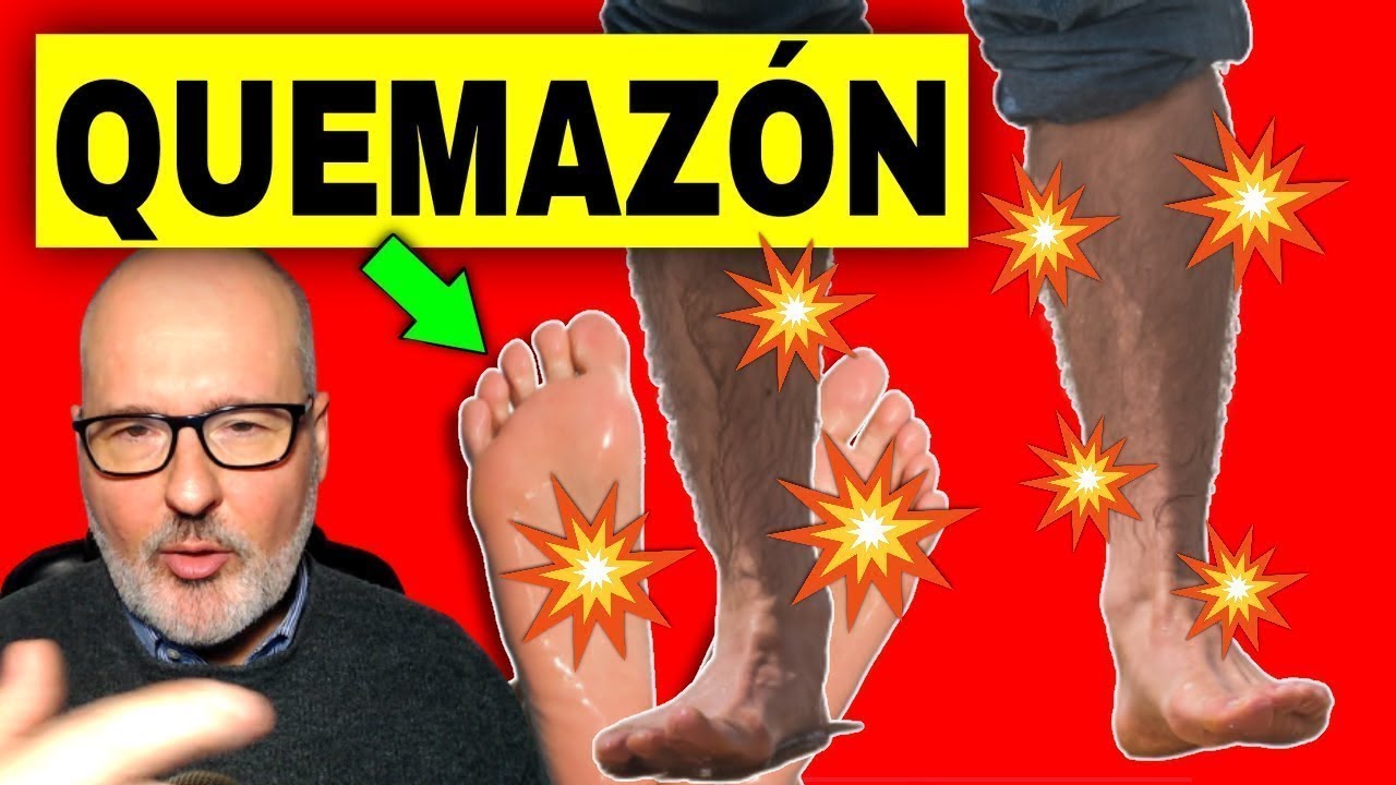 porque me arde la pierna izquierda