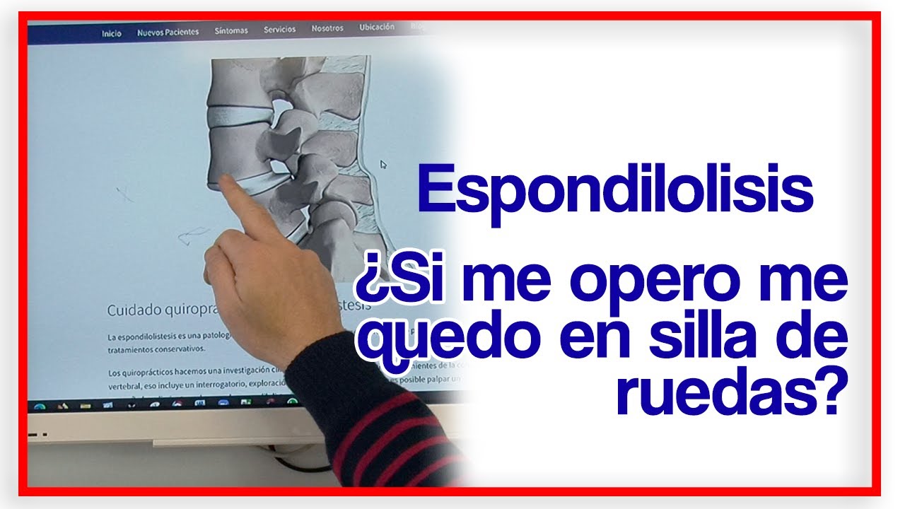 qué es listesis en l4 y l5