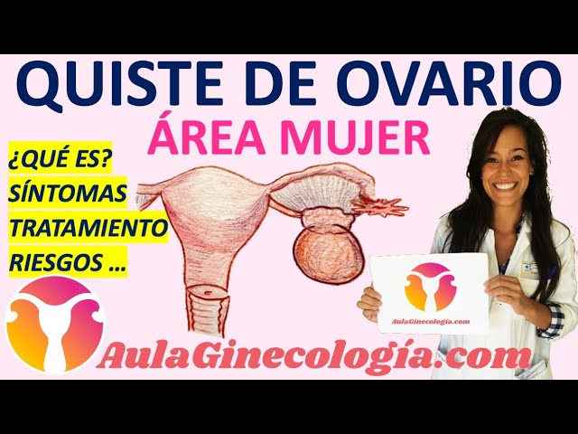 qué es un tabique en un quiste