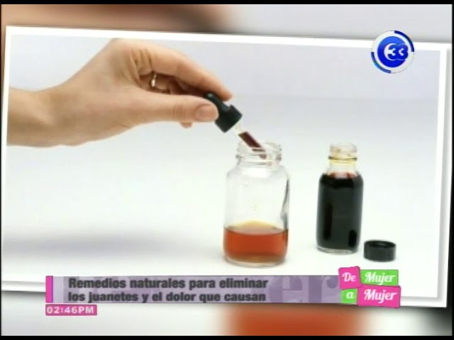 remedios caseros para el dolor de juanetes