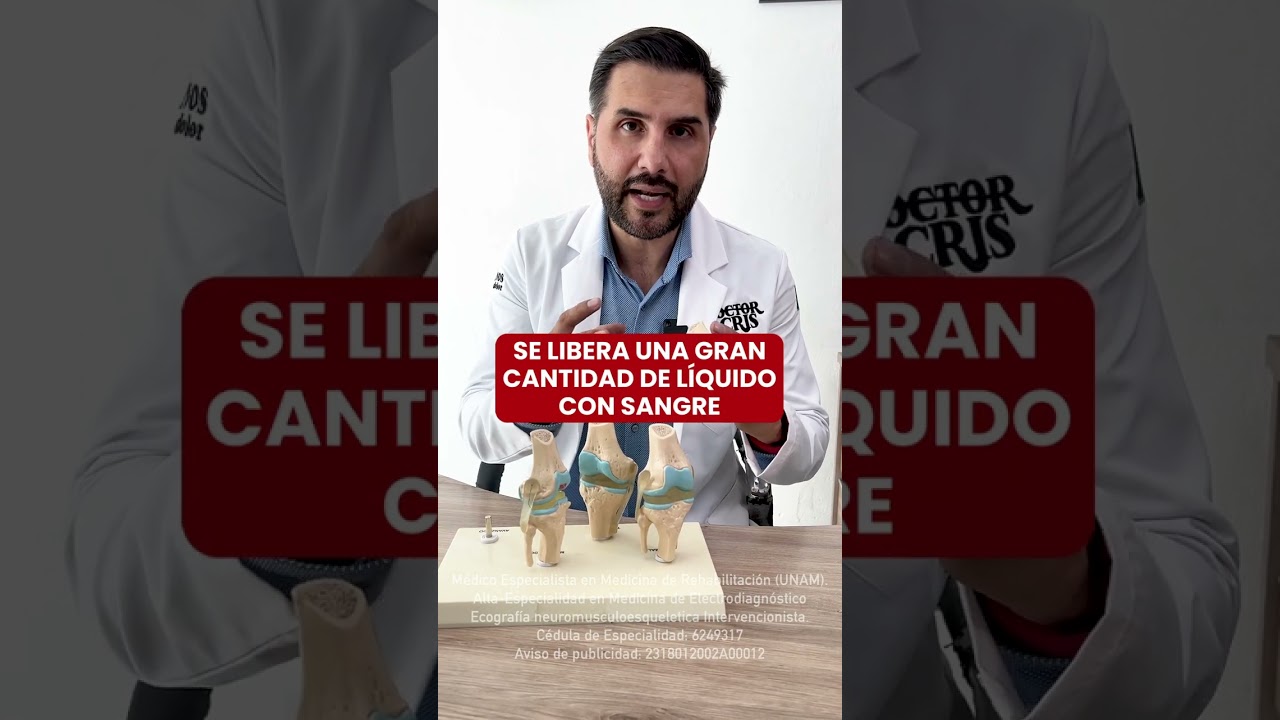 rodilla hinchada con dolor sin golpe