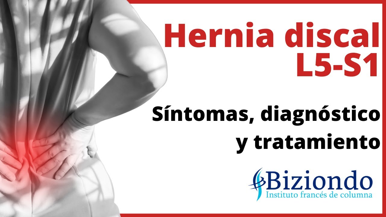sintomas de hernia discal lumbar l4 l5 s1