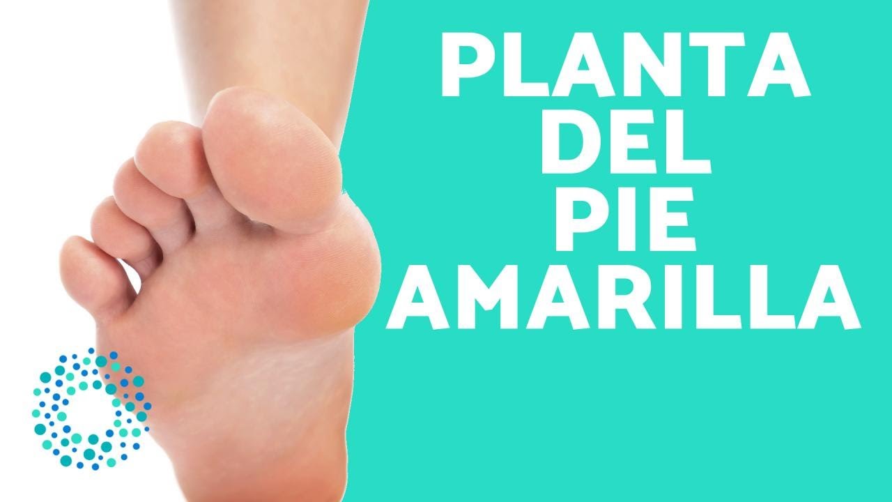 tengo la planta del pie amarilla