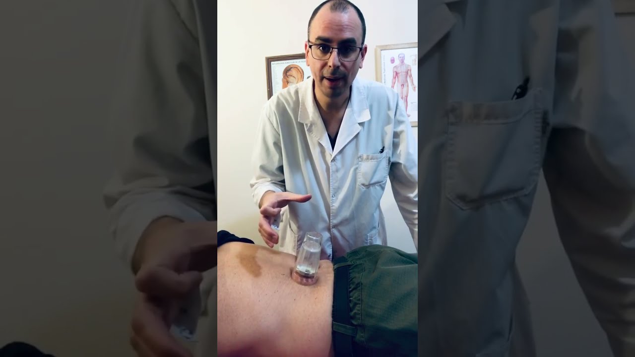 terapia con vasos en la espalda