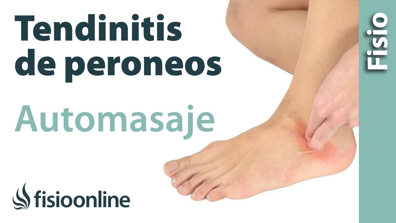 tipos de tendinitis en el pie