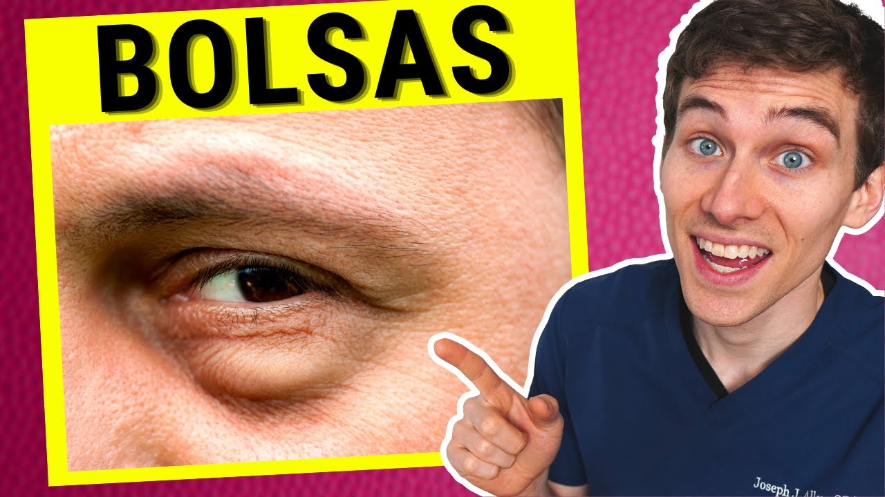 tratamiento para bolsas en los ojos