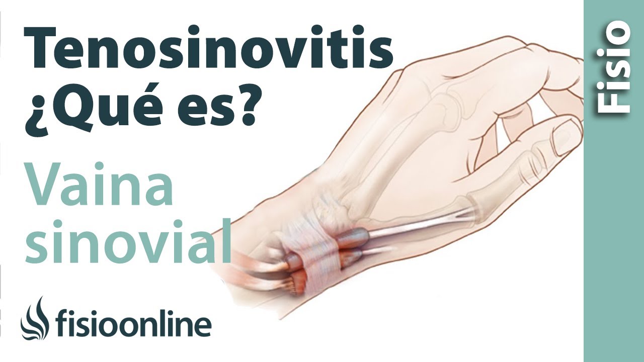 vaina sinovial comun de los musculos flexores